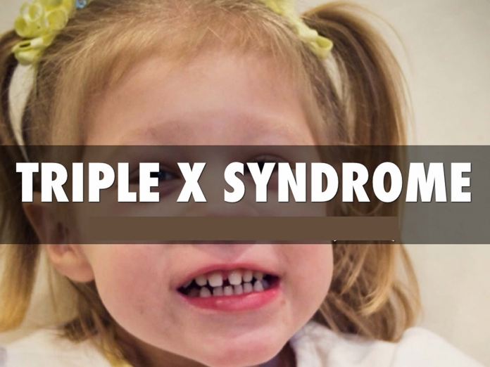 Triple X Syndrome