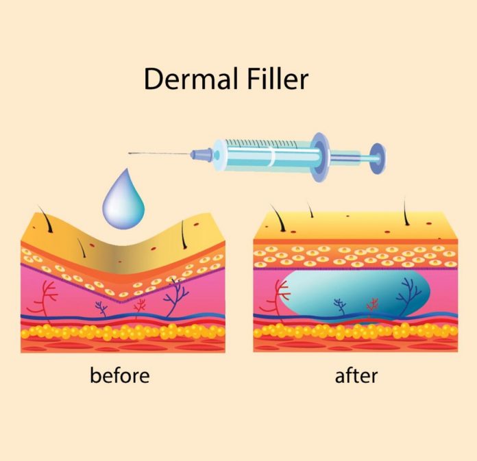 DermaFillers