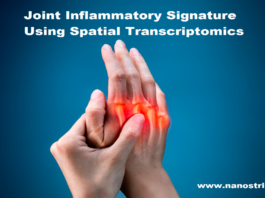 Join Inflammatory pain in hand fingers