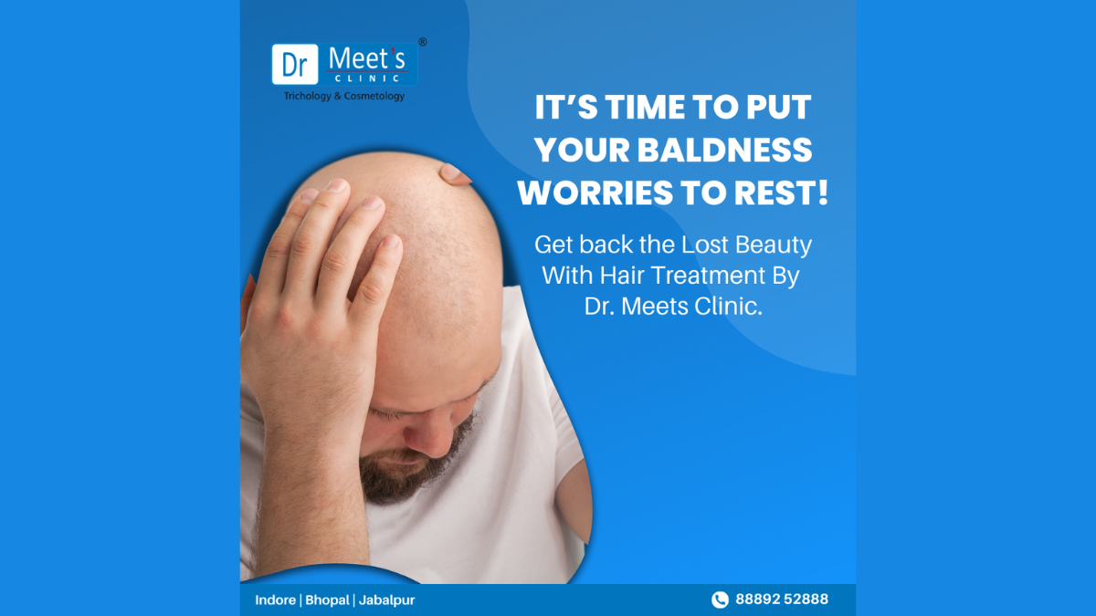 hair loss treatment in Indore