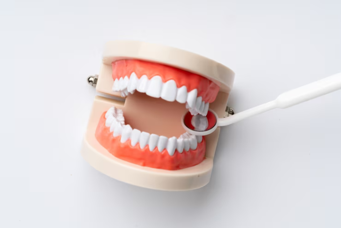 dental implants harrisonburg va