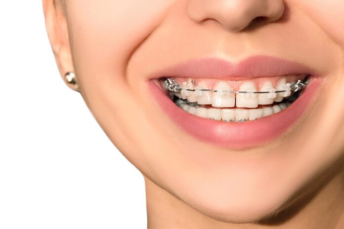 How do I choose the best dental braces clinic in Houston for my needs?