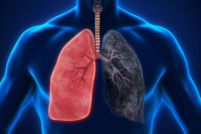 What effect does smoking have on lung biology?