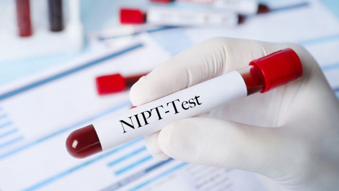 The Role of NIPT in Down Syndrome Screening A New Era of Prenatal Care