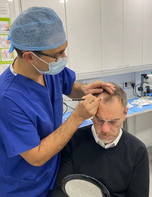 hair transplant london