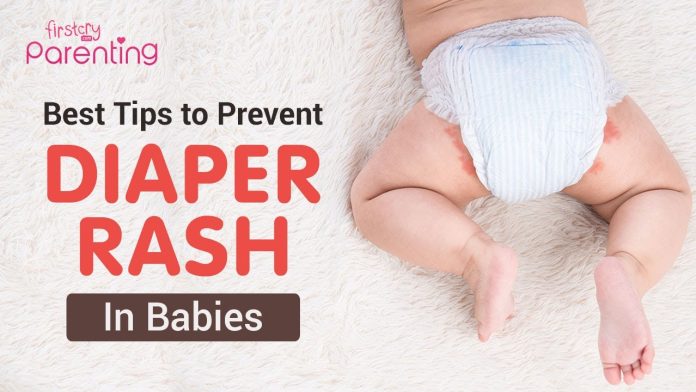 Nappy Rash: Causes and Remedies