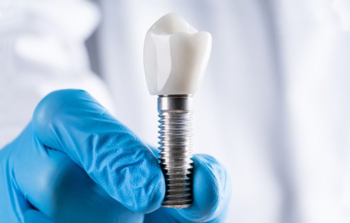 Prioritizing Your Health The Crucial Role of Cleanliness in Dental Implant Clinics