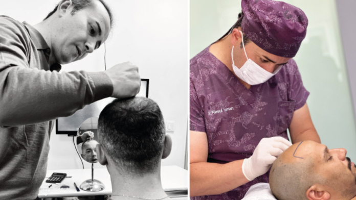 5 Reasons to Choose a Hair Transplant Turkey