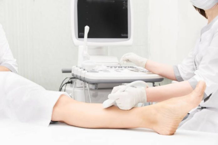 Exploring Cosmetic Vein Treatments What Are Your Options