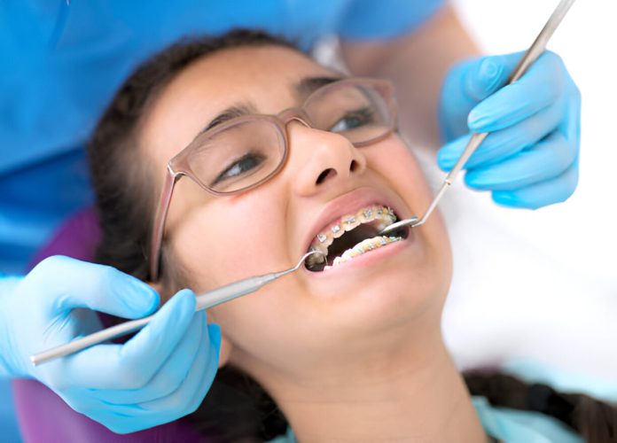 Orthodontic Consultation