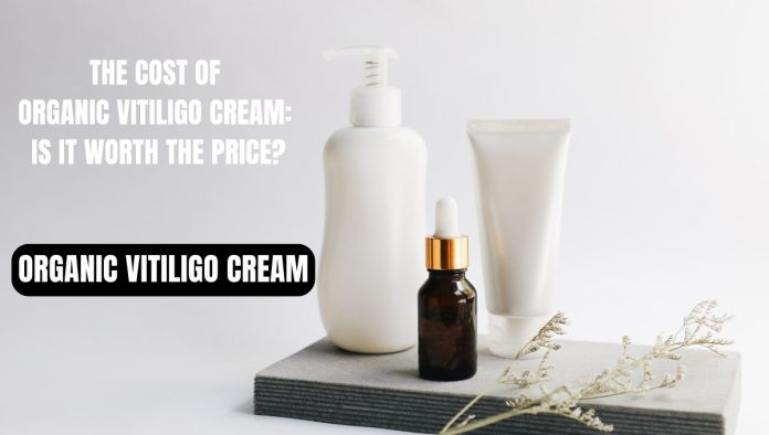 organic vitiligo creams