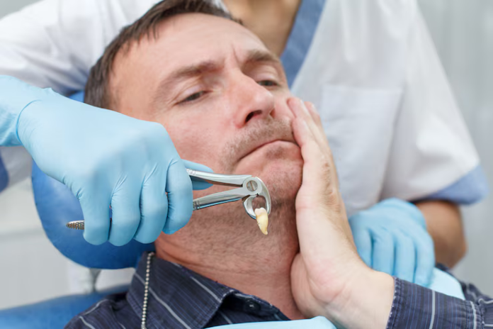 wisdom tooth extraction jensen beach fl