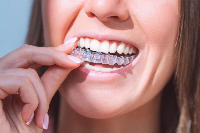 invisalign san antonio tx