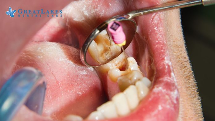 Dental