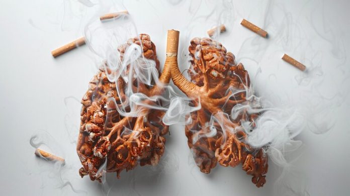 Never Smoked But Have Lung Cancer Here’s Why It’s Happening 