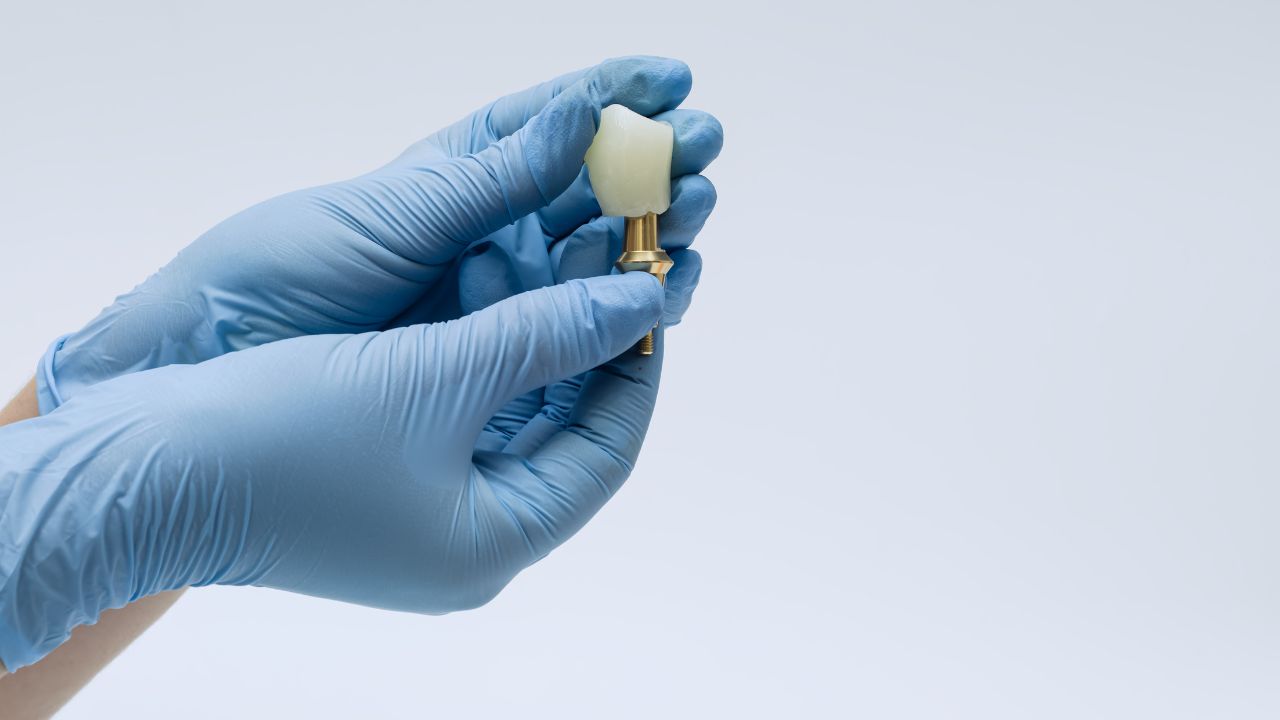 zirconium crowns DentPrime